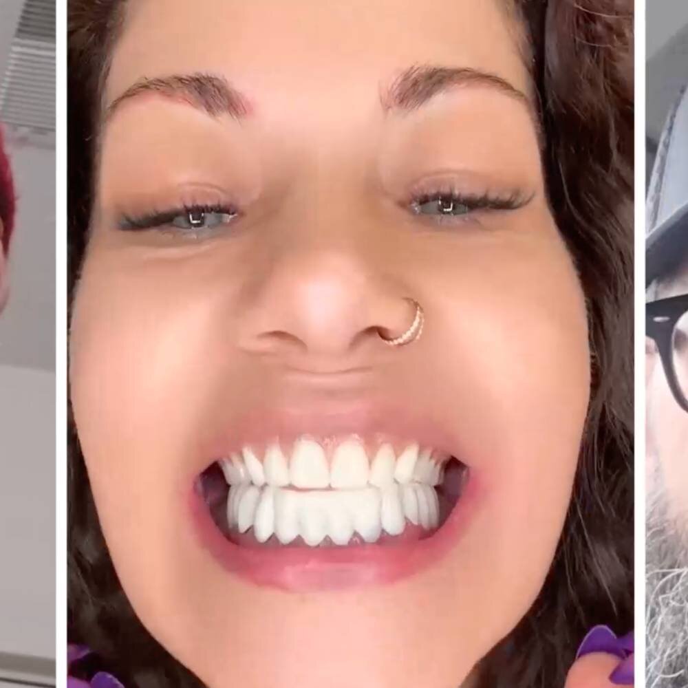 Différentes personnes souriant avec les facettes WellaSmile